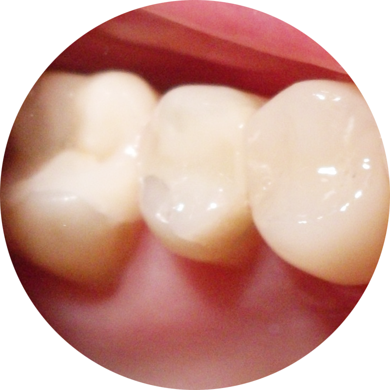 tooth-dental-implant-oral-hygiene-jaw-dentistry-fillings-23c2273d86c600b90a63f47a155f0890